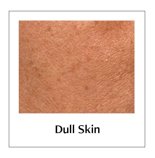Rubar Skin Nirva